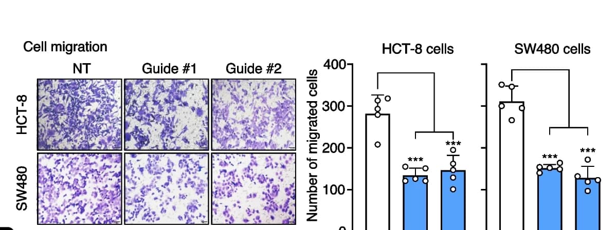 Open access visualization of Bar Plot, Error Bars, Microscopy, Tumor Cell Migration, HCT-8 Cells