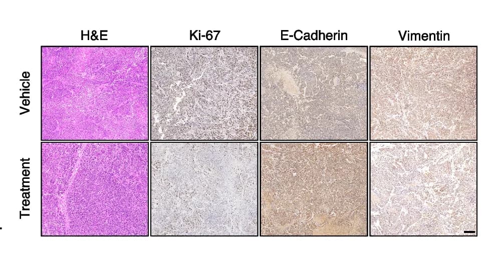 Open access visualization of Microscopy, H&E Staining, IHC, Tumors