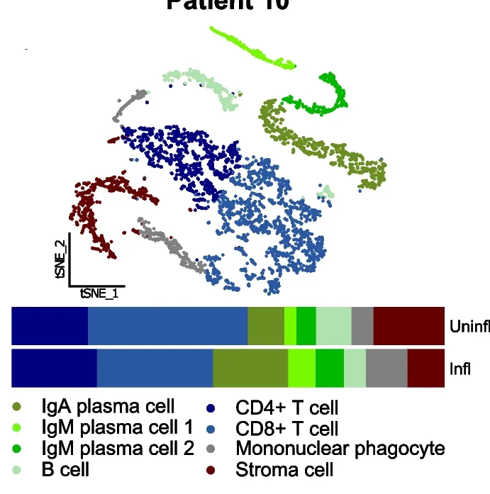 Open access visualization of UMAP, Scatter Plot, Bar Plot, Stacked Bar Plot, Patients