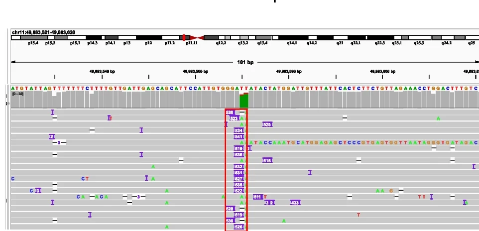 Open access visualization of Locuszoom Plot, IGV Plot, Long-Read Data, Insertion Sequences