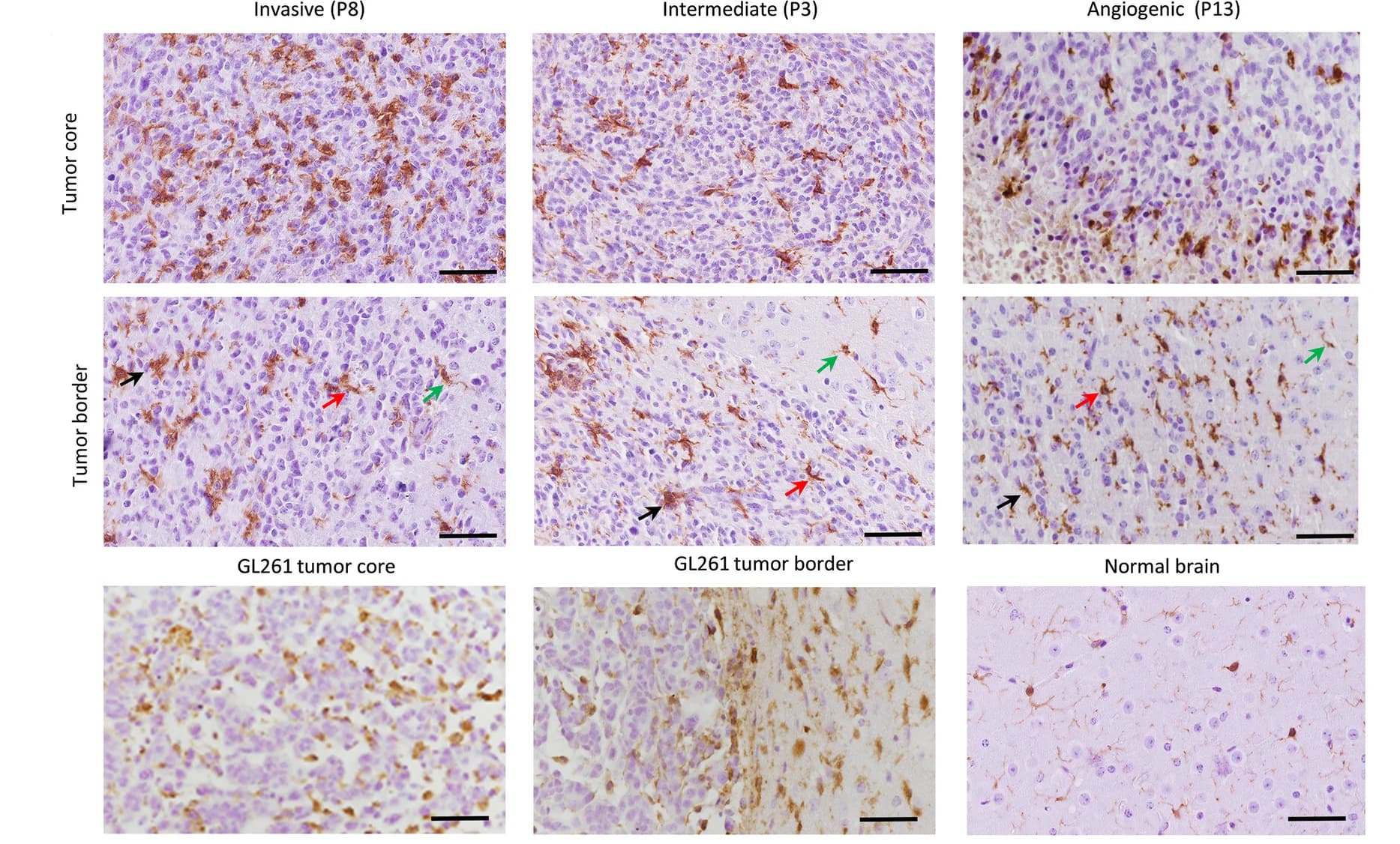 Open access visualization of Microscopy, Iba1 Staining, PDOXs, Myeloid Cells, Tumor Growth