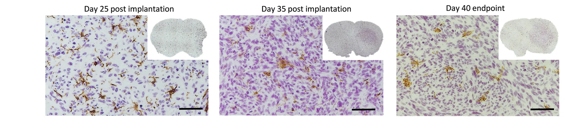 Open access visualization of Microscopy, Iba1 Staining, Myeloid Cells, PDOX P3, Tumor Growth