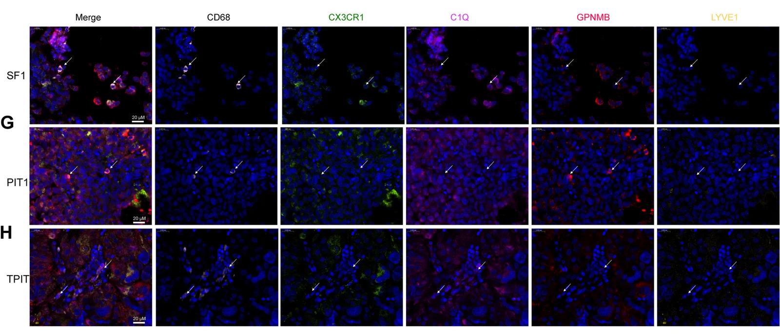 Open access visualization of Microscopy, Immunofluorescence, CX3CR1+ Macrophages, GPNMB+ Macrophages, C1Q+ Macrophages