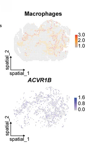 Open access visualization of Scatter Plot, Spatial Feature Plot, Macrophages, ST Spots, Deconvolution