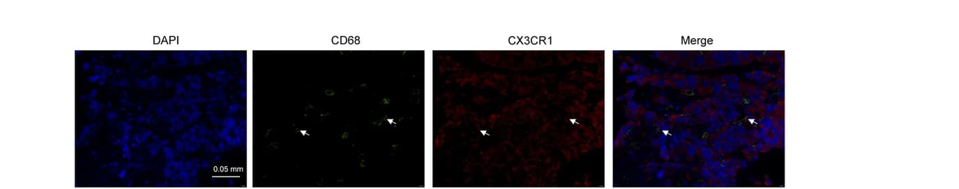 Open access visualization of Microscopy, CD68, CX3CR1, Xenografts, Mice