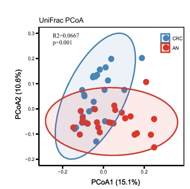 Open access visualization of Scatter Plot, PCA, Beta Diversity, Bray-Curtis Distance, PCoA Analysis