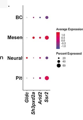 Open access visualization of Bubble Plot, Scatter Plot, Dot Plots, Gene Expression, Mesenchyme