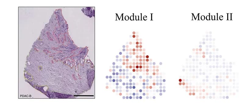 Open access visualization of Microscopy, Scatter Plot, Histological Annotation, Tissue Modules, Cancer Cells