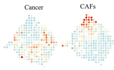 Open access visualization of Scatter Plot, Spatial Distributions, Cancer, CAFs, CARD