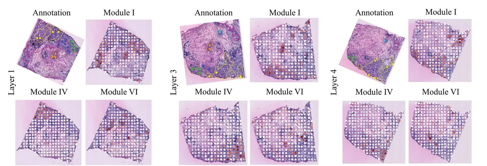Open access visualization of Microscopy, Scatter Plot, Tissue Modules, Spatial Maps, Biopsy