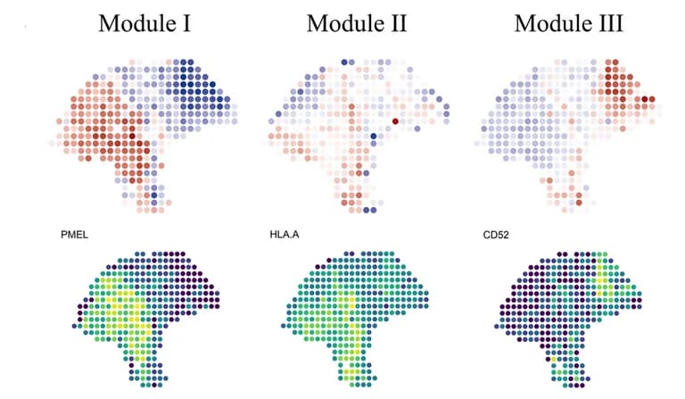 Open access visualization of Scatter Plot, Heatmap, Spatial Maps, Tissue Modules, STModule