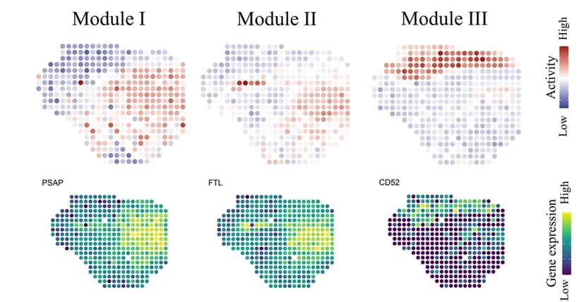 Open access visualization of Heatmap, Spatial Maps, Tissue Modules, STModule, Melanoma