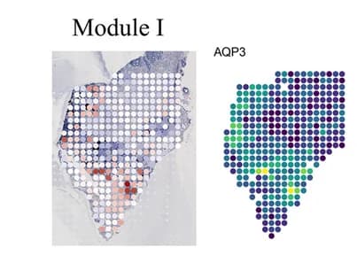 Open access visualization of Heatmap, Spatial Maps, Module Identification, STModule, Prostate Cancer