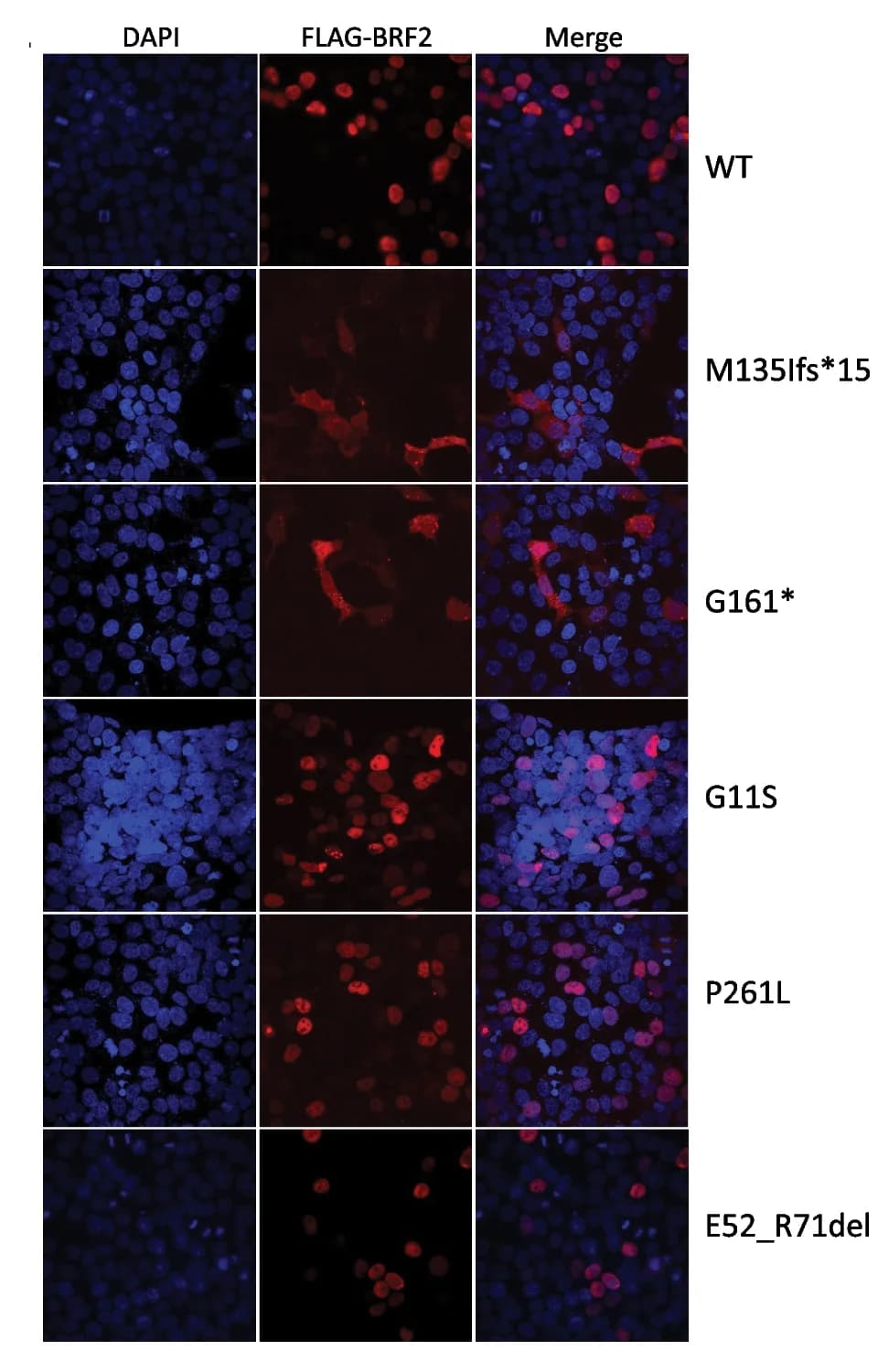 Open access visualization of Microscopy, Subcellular Localization, FLAG-BRF2, Immunofluorescent Staining, DAPI
