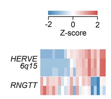 Gene Expression Heatmaps: Pattern Recognition in Biological Research Publications