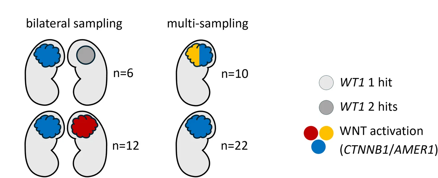 Open access visualization of Illustration, WT1, Contralateral Samples, Tumor, WNT Activating Alterations