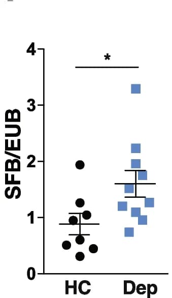Open access visualization of Scatter Plot, Error Bars, Fecal SFB, q-PCR, Mice