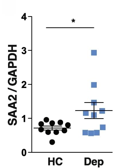 Open access visualization of Scatter Plot, Error Bars, SAA2, qRT-PCR, Mice