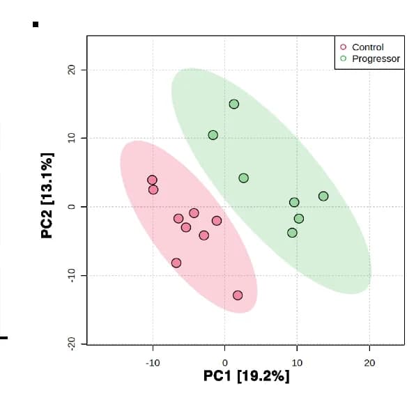 Open access visualization of Scatter Plot, PCA, Partial least square-discrimination analysis, Plasma metabolites, CD progressors