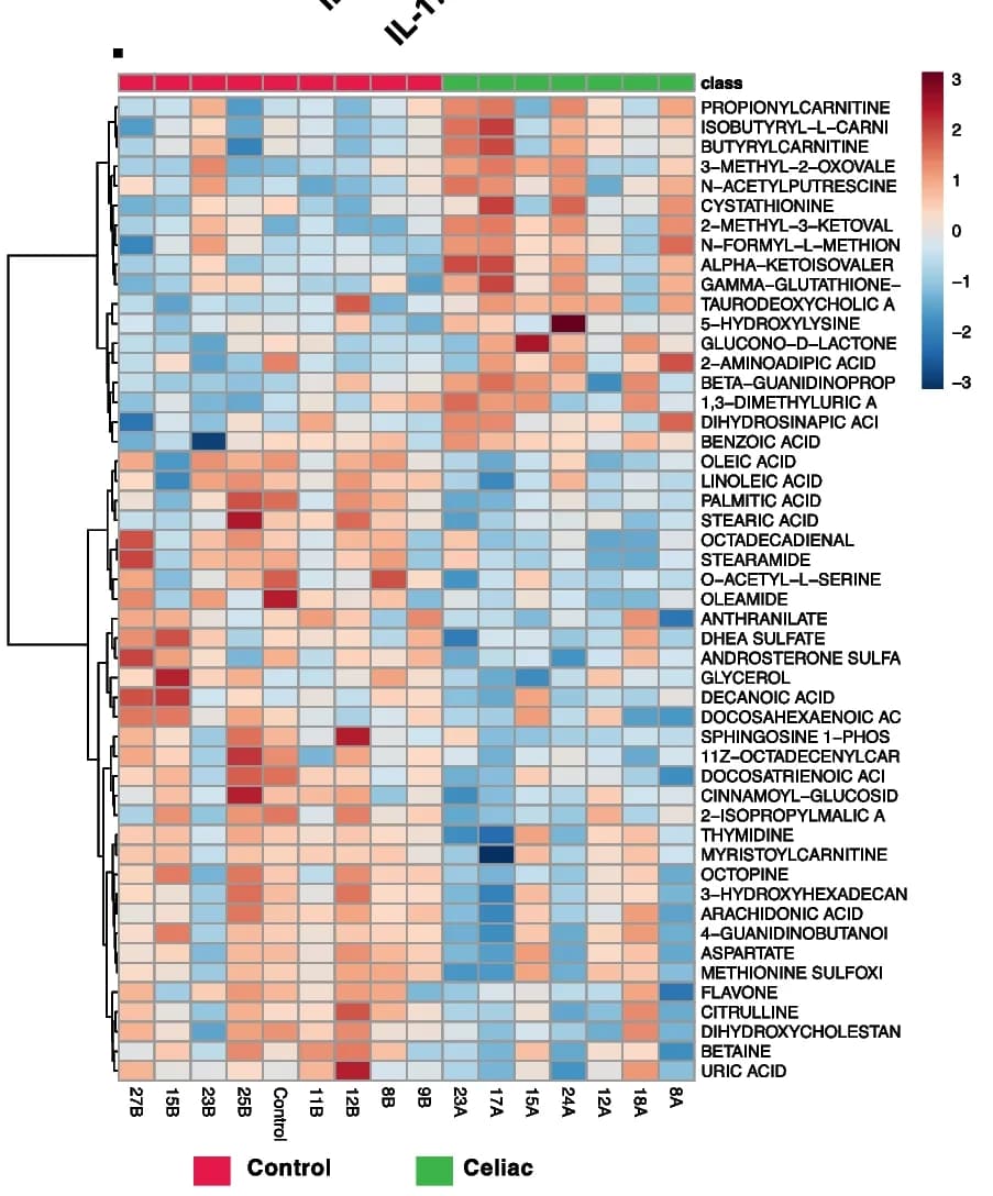 Open access visualization of Heatmap, Clustered, Altered metabolites, CD progressors, Healthy controls