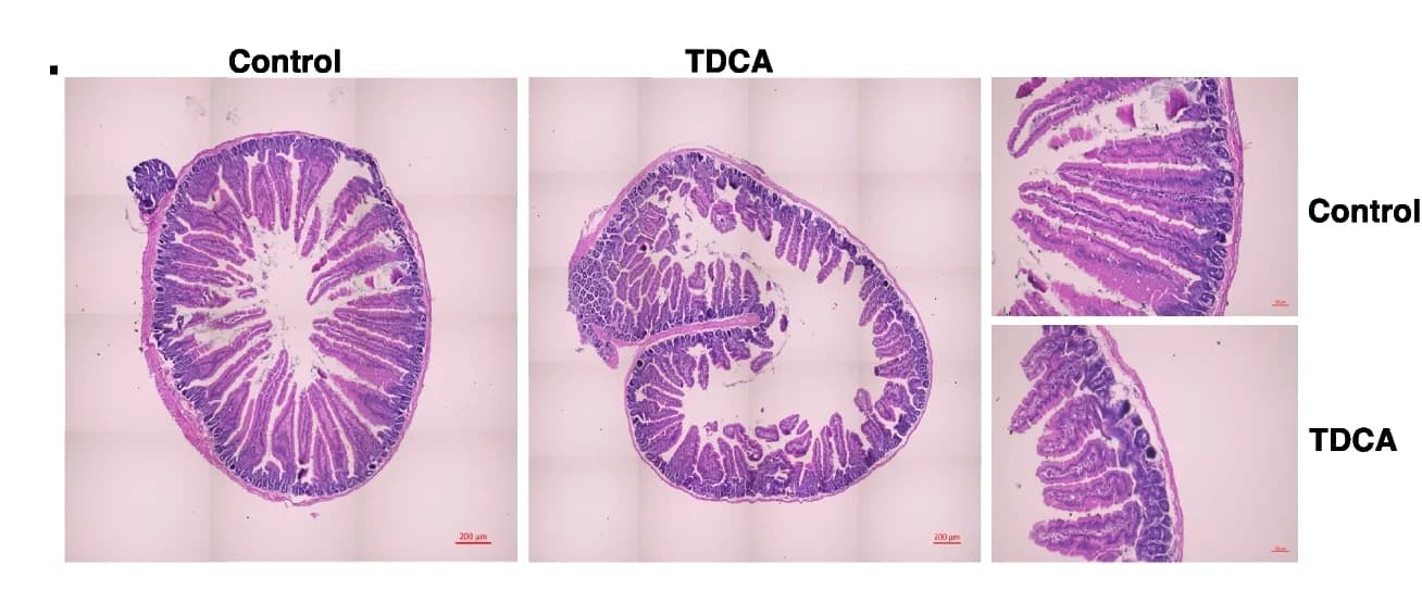Open access visualization of Microscopy, Photo, H&E Staining, Duodenum, Histology