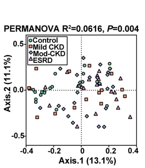 Open access visualization of Scatter Plot, PCA, Principal Coordinate Analysis, Bray-Curtis Dissimilarity, Gut Microbial Composition