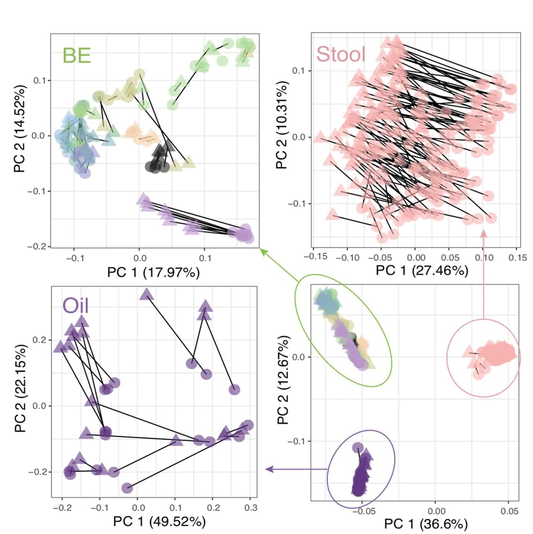 Open access visualization of Scatter Plot, PCA, PCoA, Bray-Curtis dissimilarity, OTUs