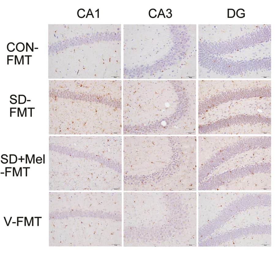 Open access visualization of Microscopy, Immunohistochemical Microglia, Experimental Groups, ImageJ
