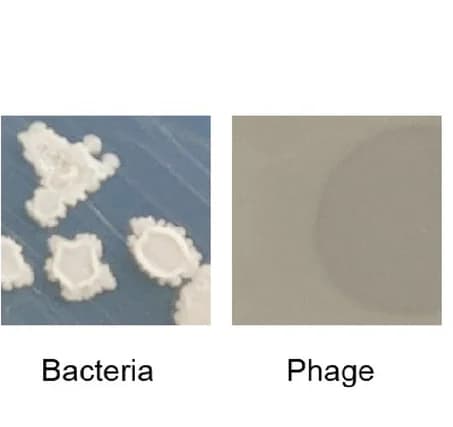 Open access visualization of Photo, Microscopy, Colony morphology, Plaque morphology, Inhibitor bacteria