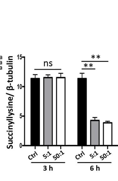 Open access visualization of Bar Plot, Error Bars, Lysine-succinylated Proteins, β-tubulin, Western Blots