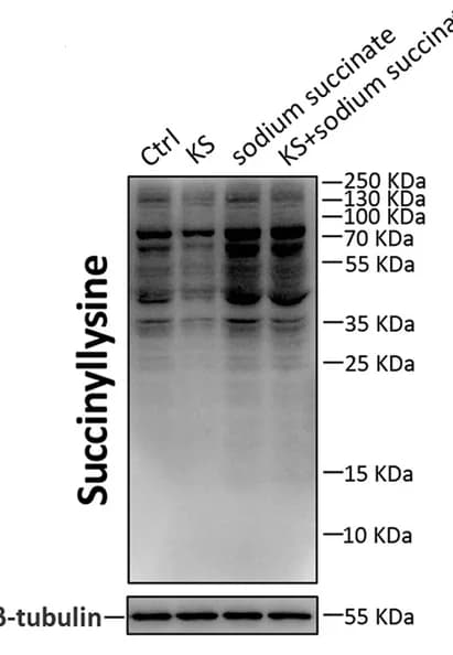 Open access visualization of Gel, Western Blots, Lysine-Succinylate Proteins, Beta-Tubulin, IPEC-J2 Cells