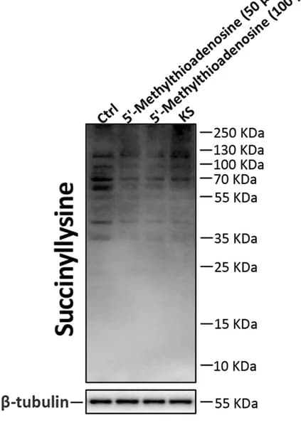 Open access visualization of Gel, Western Blots, Lysine-succinylated Proteins, β-tubulin, IPEC-J2 Cells
