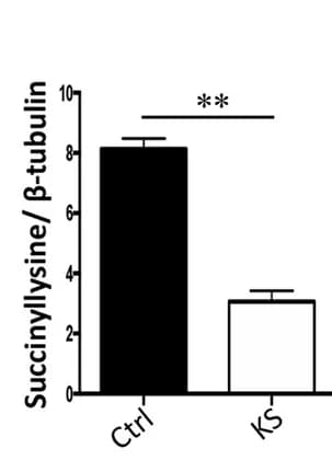 Open access visualization of Bar Plot, Error Bars, Lysine-succinylated Proteins, Beta-tubulin, Quantification