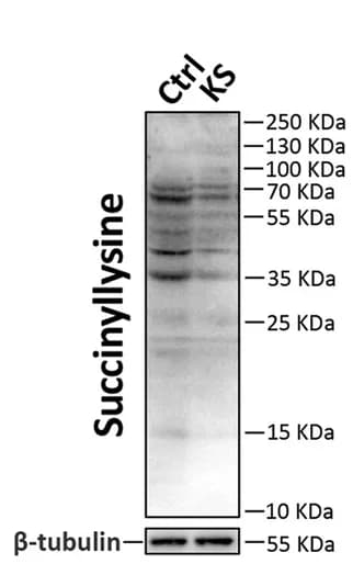 Open access visualization of Gel, Western Blots, Lysine-succinylated Proteins, Beta-tubulin, Jejunal Epithelial Cells