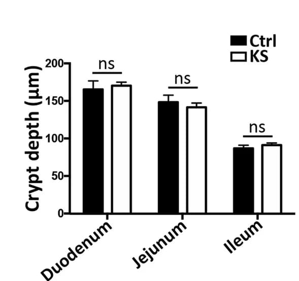 Open access visualization of Clustered, Error Bars, Crypt Depth, Statistical Analysis