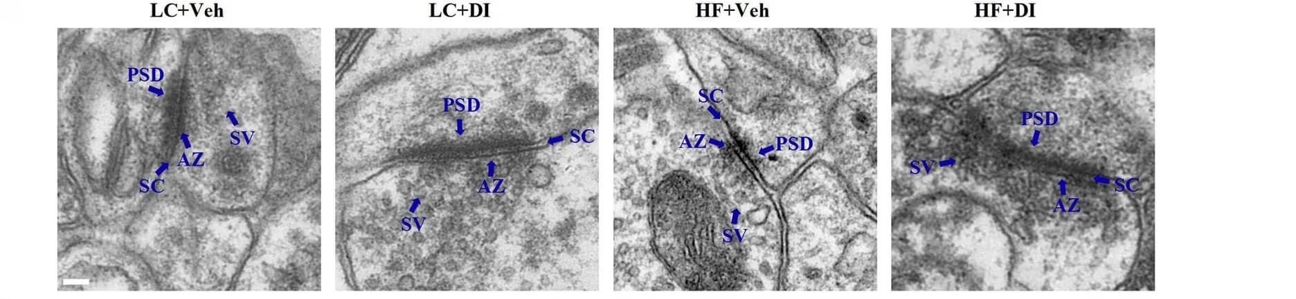 Open access visualization of Microscopy, Synapses, Cornu Ammonis 1, CA1 Region, Electron Micrograph