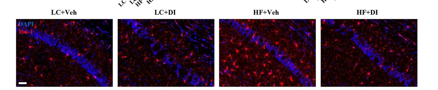 Open access visualization of Microscopy, Immunofluorescent Staining, Iba-1, Cornu Ammonis 1, CA1 Region