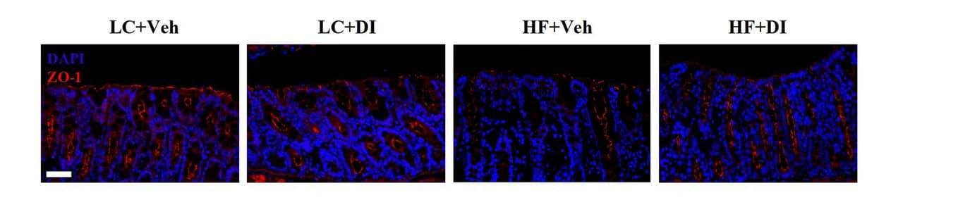 Open access visualization of Microscopy, Immunofluorescence, Colonic Sections, ZO-1, DAPI