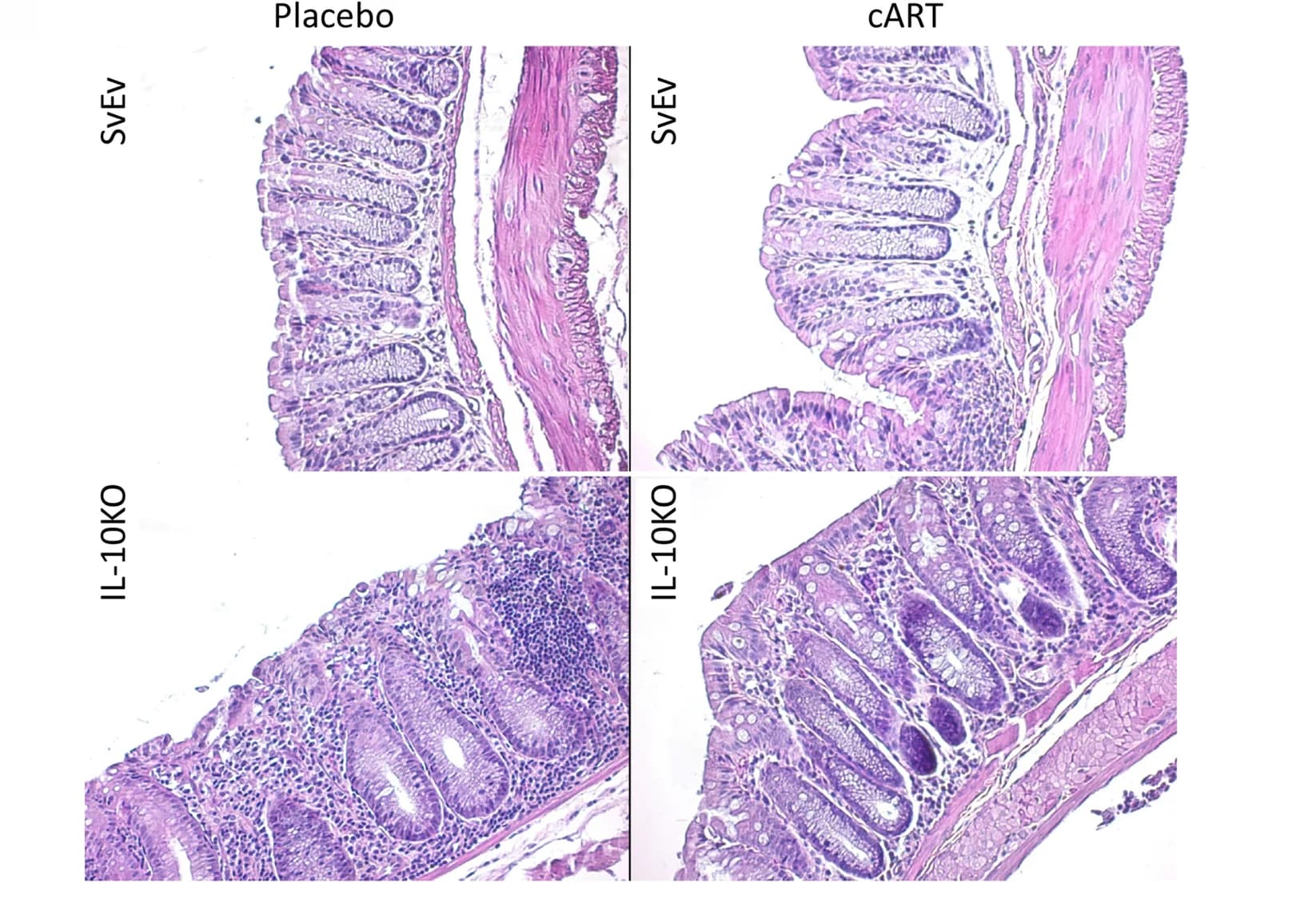 Open access visualization of Microscopy, Hematoxylin and eosin stain, Colon tissues, Inflammation, IL-10 -/- mice