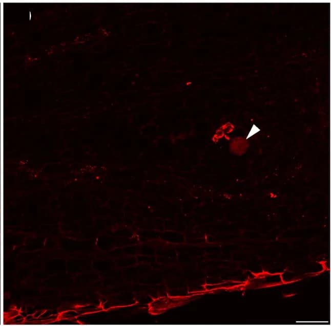 Open access visualization of Microscopy, Fluorescence, Nitrogen-fixing bacteria, Root-knot nematode, Adult Females