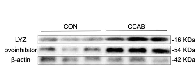Open access visualization of Gel, LYZ, Ovoinhibitor, Magnum, Western Blotting