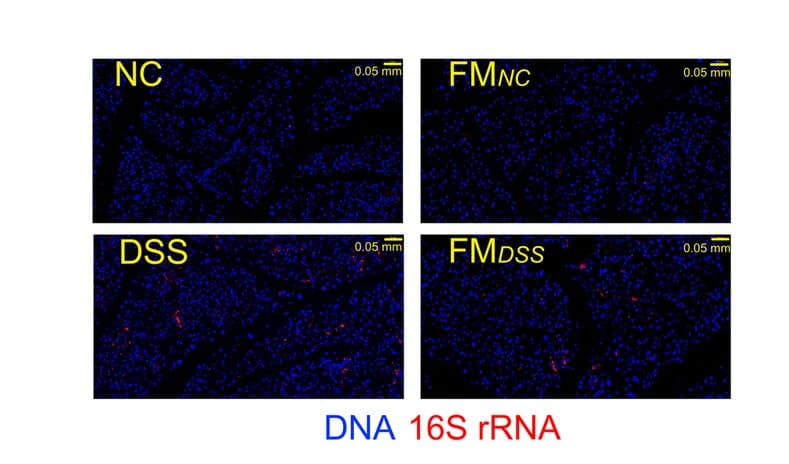 Open access visualization of Microscopy, Bacterial load, Pancreas, Fluorescence in situ hybridization, FISH