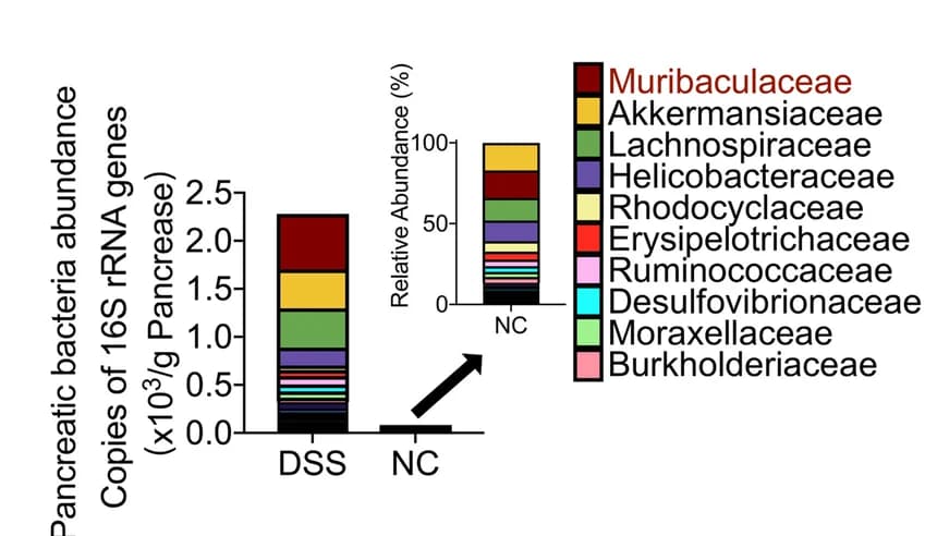 Open access visualization of Stacked Bar Plot, Family-level phylotypes, Pancreas, DSS-treated mice, qPCR
