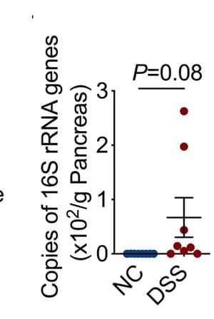Open access visualization of Scatter Plot, Error Bars, Muribaculaceae ASVs, Pancreas, Relative abundance