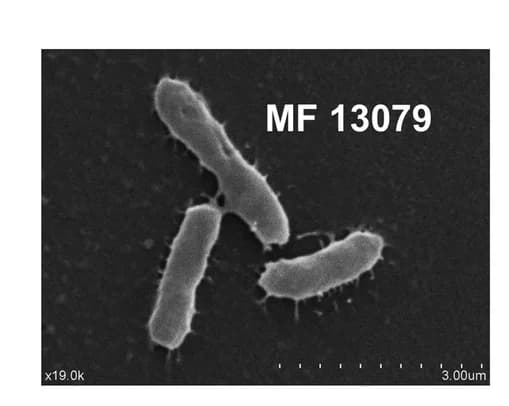Open access visualization of Microscopy, Scanning Electron Microscopy, Muribaculaceae, DSS Treatment, Gut Microbiota
