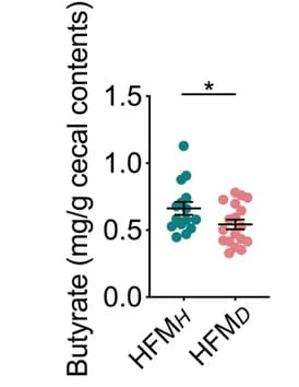 Open access visualization of Scatter Plot, Error Bars, Bacterial Load, Pancreas, HFM H Mice