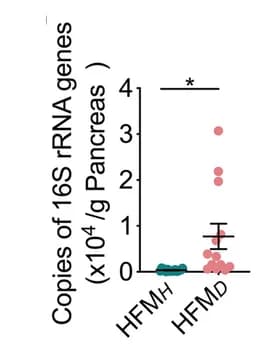 Open access visualization of Scatter Plot, Flow Cytometry, Leukocyte Subtypes, Pancreas, HFM H Mice