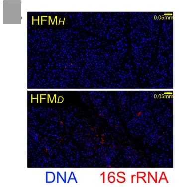 Open access visualization of Microscopy, Histological Sections, Pancreatic Tissue, HFM H Mice, HFM D Mice