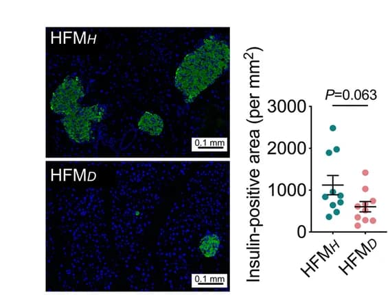 Open access visualization of Scatter Plot, Error Bars, H&E Staining, Histological Sections, Pancreatic Tissue