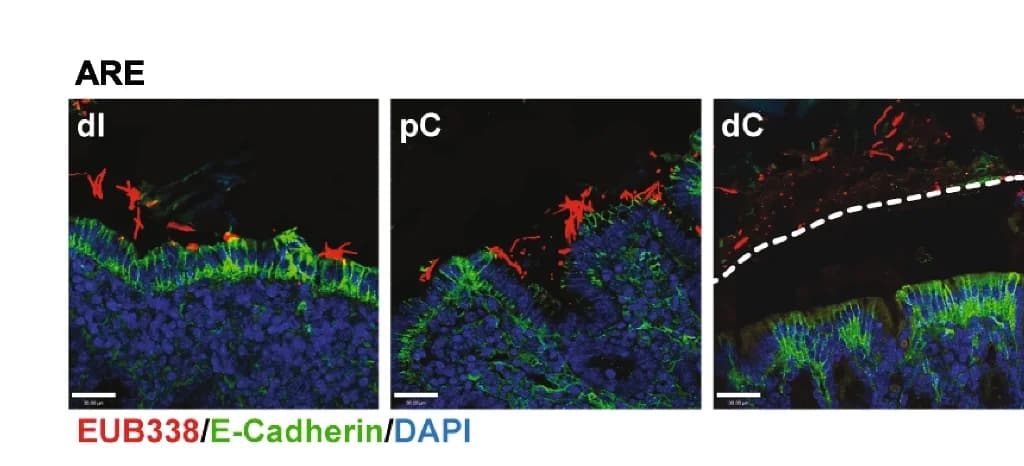 Open access visualization of Microscopy, FISH, Eubacterial probe, Tissue sections, Distal ileum